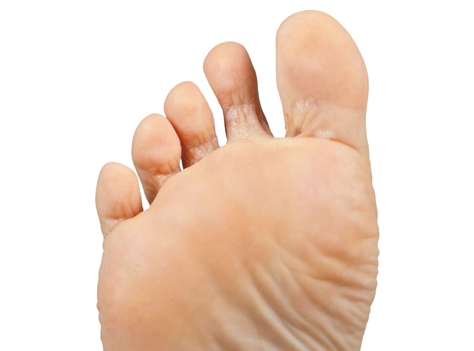 Funger-Good-and-Leal-and-Hectic-Cream-Demyxil